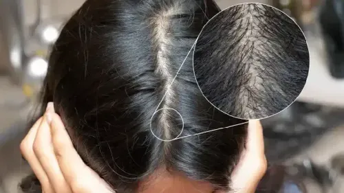 Best Natural Oils for Your Scalp Health and Hair Growth
